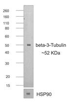 Mouse IgG (H+L) Secondary Antibody in Western Blot (WB)