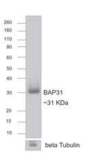 Rat IgG (H+L) Secondary Antibody in Western Blot (WB)