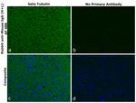 Mouse IgG (H+L) Secondary Antibody in Immunohistochemistry (Paraffin) (IHC (P))