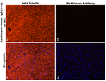 Mouse IgG (H+L) Secondary Antibody in Immunohistochemistry (Paraffin) (IHC (P))