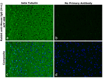 Mouse IgG (H+L) Secondary Antibody in Immunohistochemistry (Paraffin) (IHC (P))