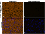 Mouse IgG (H+L) Secondary Antibody in Immunohistochemistry (Paraffin) (IHC (P))