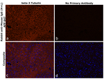 Mouse IgG (H+L) Secondary Antibody in Immunohistochemistry (Paraffin) (IHC (P))