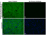 Mouse IgG (H+L) Secondary Antibody in Immunohistochemistry (Paraffin) (IHC (P))