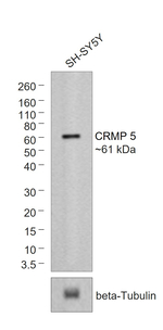 Rat IgG (H+L) Secondary Antibody in Western Blot (WB)