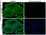 Rabbit IgG (H+L) Secondary Antibody in Immunohistochemistry (Paraffin) (IHC (P))