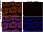 Rabbit IgG (H+L) Secondary Antibody in Immunohistochemistry (Paraffin) (IHC (P))