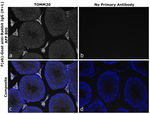 Rabbit IgG (H+L) Secondary Antibody in Immunohistochemistry (Paraffin) (IHC (P))