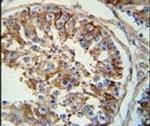 SPACA1 Antibody in Immunohistochemistry (IHC)