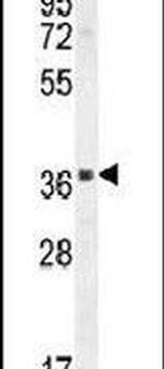 SPACA1 Antibody in Western Blot (WB)