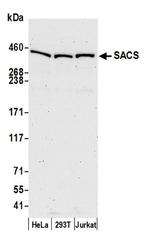 SACS Antibody in Western Blot (WB)