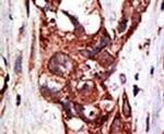 SAE1 Antibody in Immunohistochemistry (IHC)