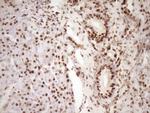 SAE1 Antibody in Immunohistochemistry (Paraffin) (IHC (P))