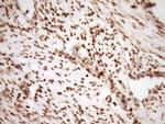SAE1 Antibody in Immunohistochemistry (Paraffin) (IHC (P))