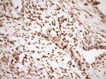 SAE1 Antibody in Immunohistochemistry (Paraffin) (IHC (P))