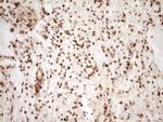 SAE1 Antibody in Immunohistochemistry (Paraffin) (IHC (P))