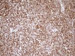 SAE1 Antibody in Immunohistochemistry (Paraffin) (IHC (P))