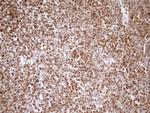 SAE1 Antibody in Immunohistochemistry (Paraffin) (IHC (P))