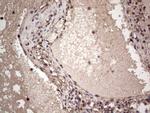 SAE1 Antibody in Immunohistochemistry (Paraffin) (IHC (P))