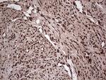 SAE1 Antibody in Immunohistochemistry (Paraffin) (IHC (P))