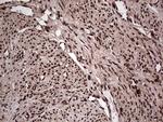SAE1 Antibody in Immunohistochemistry (Paraffin) (IHC (P))
