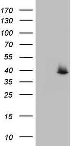 SAE1 Antibody in Western Blot (WB)