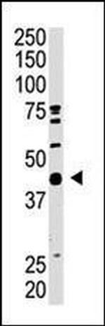 SAE1 Antibody in Western Blot (WB)