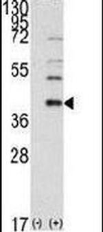 SAE1 Antibody in Western Blot (WB)