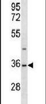 SAE1 Antibody in Western Blot (WB)