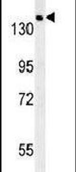 SAMD9 Antibody in Western Blot (WB)