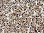 SAMHD1 Antibody in Immunohistochemistry (Paraffin) (IHC (P))