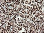 SAMHD1 Antibody in Immunohistochemistry (Paraffin) (IHC (P))