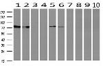 SAMHD1 Antibody in Western Blot (WB)