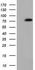 SAMHD1 Antibody in Western Blot (WB)