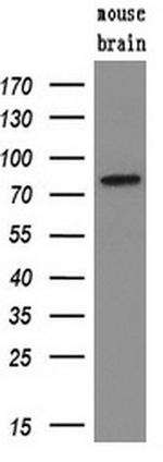 SAMHD1 Antibody in Western Blot (WB)