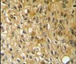 SAMSN1 Antibody in Immunohistochemistry (IHC)