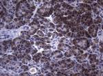 SAMSN1 Antibody in Immunohistochemistry (Paraffin) (IHC (P))