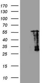SAMSN1 Antibody in Western Blot (WB)