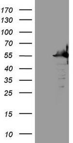 SAMSN1 Antibody in Western Blot (WB)
