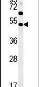 SAMSN1 Antibody in Western Blot (WB)