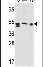 PSAP Antibody in Western Blot (WB)
