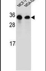 SAR1B Antibody in Western Blot (WB)