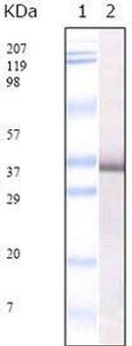 SARS Coronavirus E2 Monoclonal Antibody (4A6C9)