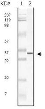SARS Coronavirus Matrix Monoclonal Antibody (2H2C4)