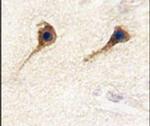 SARS2 Antibody in Immunohistochemistry (IHC)
