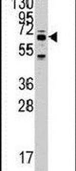 SARS2 Antibody in Western Blot (WB)