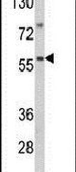 SARS2 Antibody in Western Blot (WB)