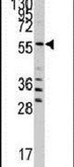 Seryl-tRNA synthetase Antibody in Western Blot (WB)