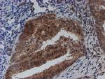 SAT2 Antibody in Immunohistochemistry (Paraffin) (IHC (P))
