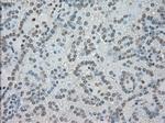 SATB1 Antibody in Immunohistochemistry (Paraffin) (IHC (P))
